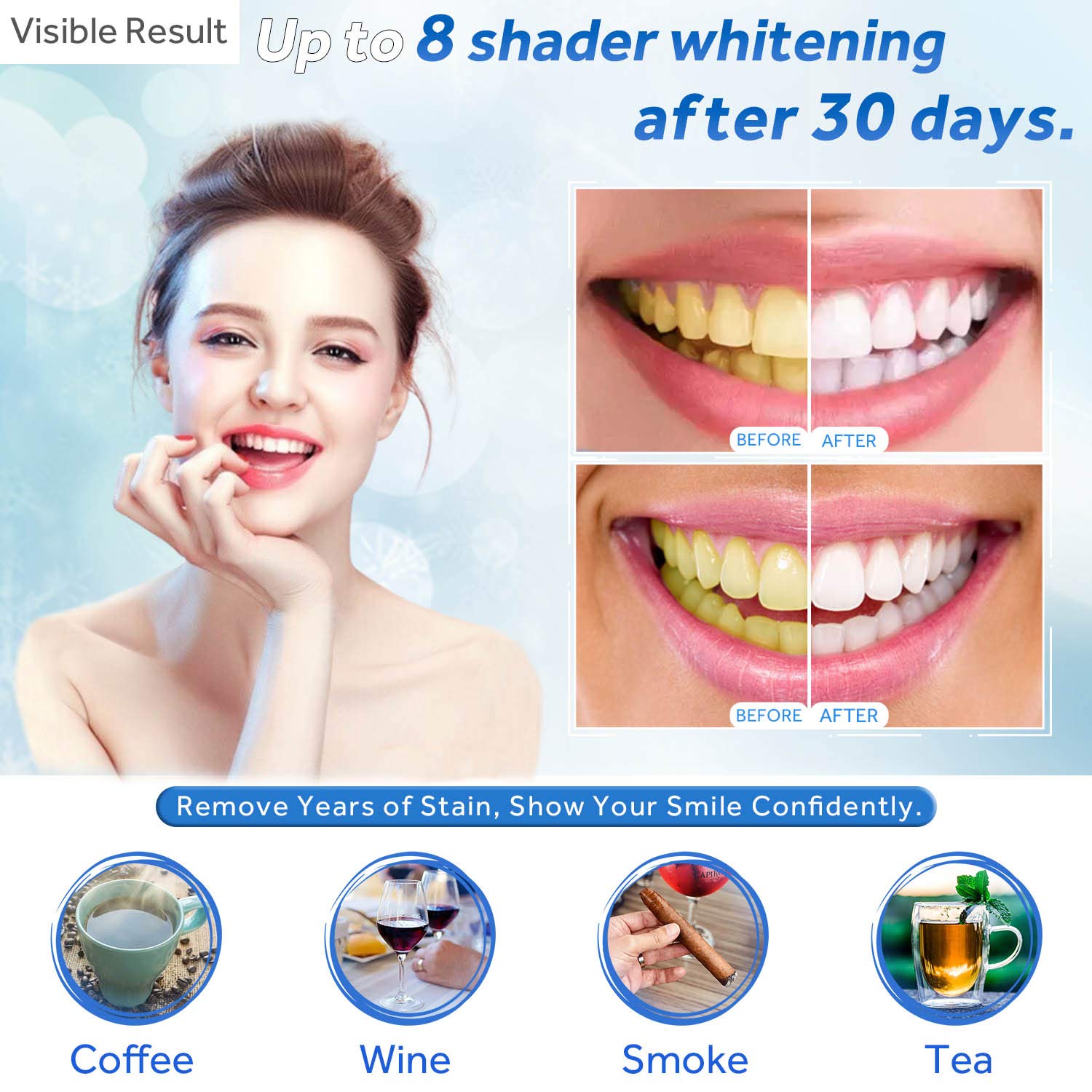 Teeth Whitening Gel Refill Syr - đánh giá và giá Teeth Whitening Paste