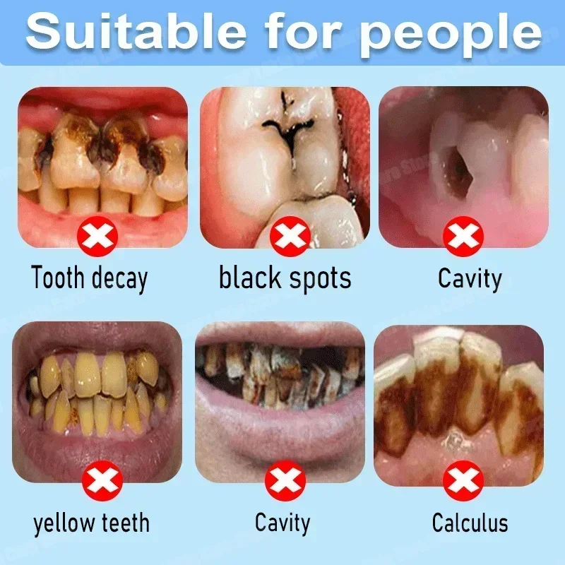 Anti Decay Toothpaste Repairs  - đánh giá và giá Teeth Whitening Uv