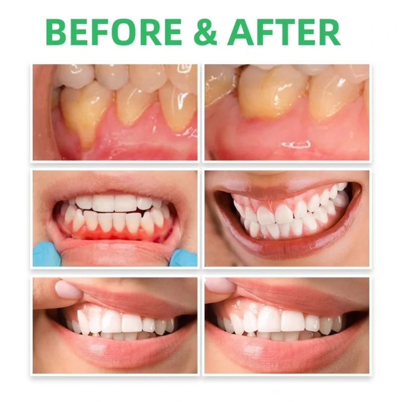 Gum Repair Drops Relieve Reced - đánh giá và giá Teeth Whitening Paste