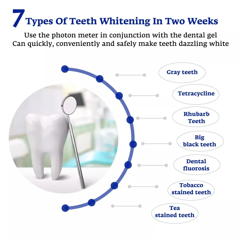 Teeth Whitening Accelerator Sm - đánh giá và giá Teeth Whitening Uv
