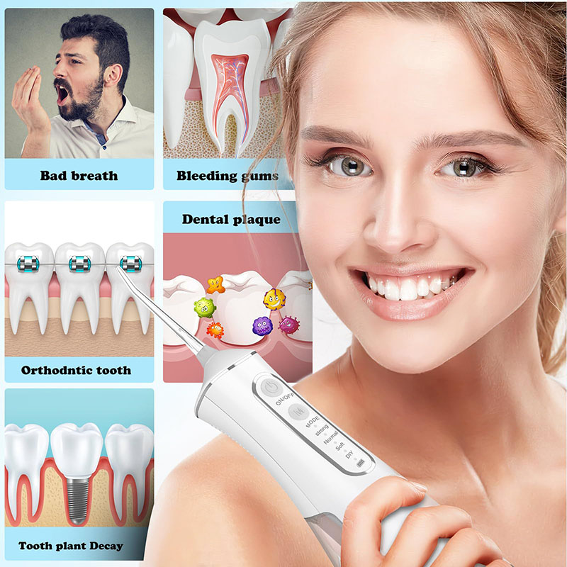 Professional Flossing Portable - đánh giá và giá Water Flosser Cordless
