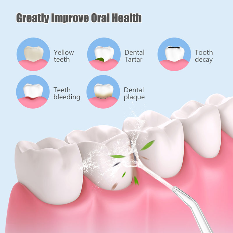 Professional Flossing Portable - đánh giá và giá Water Flosser Cordless