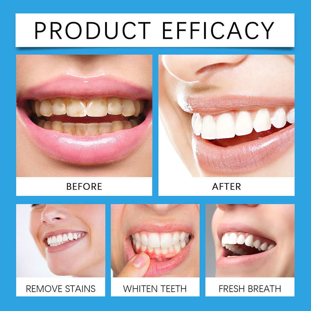 Professional Teeth Stain Remov - đánh giá và giá Teeth Whitening For Photos